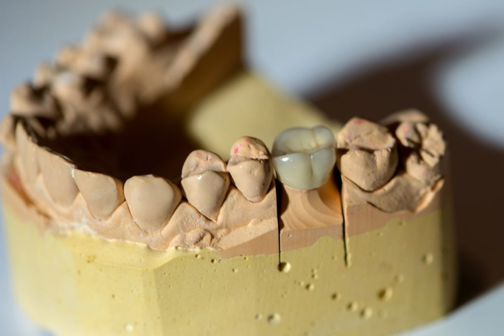 Dental Crown